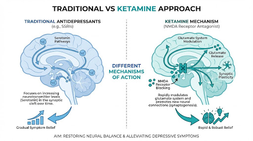 Ketamine Therapy